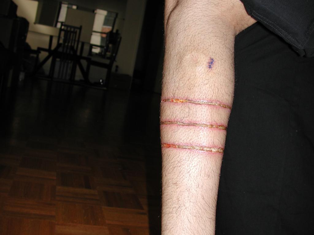 10days partiallypeeled jpg